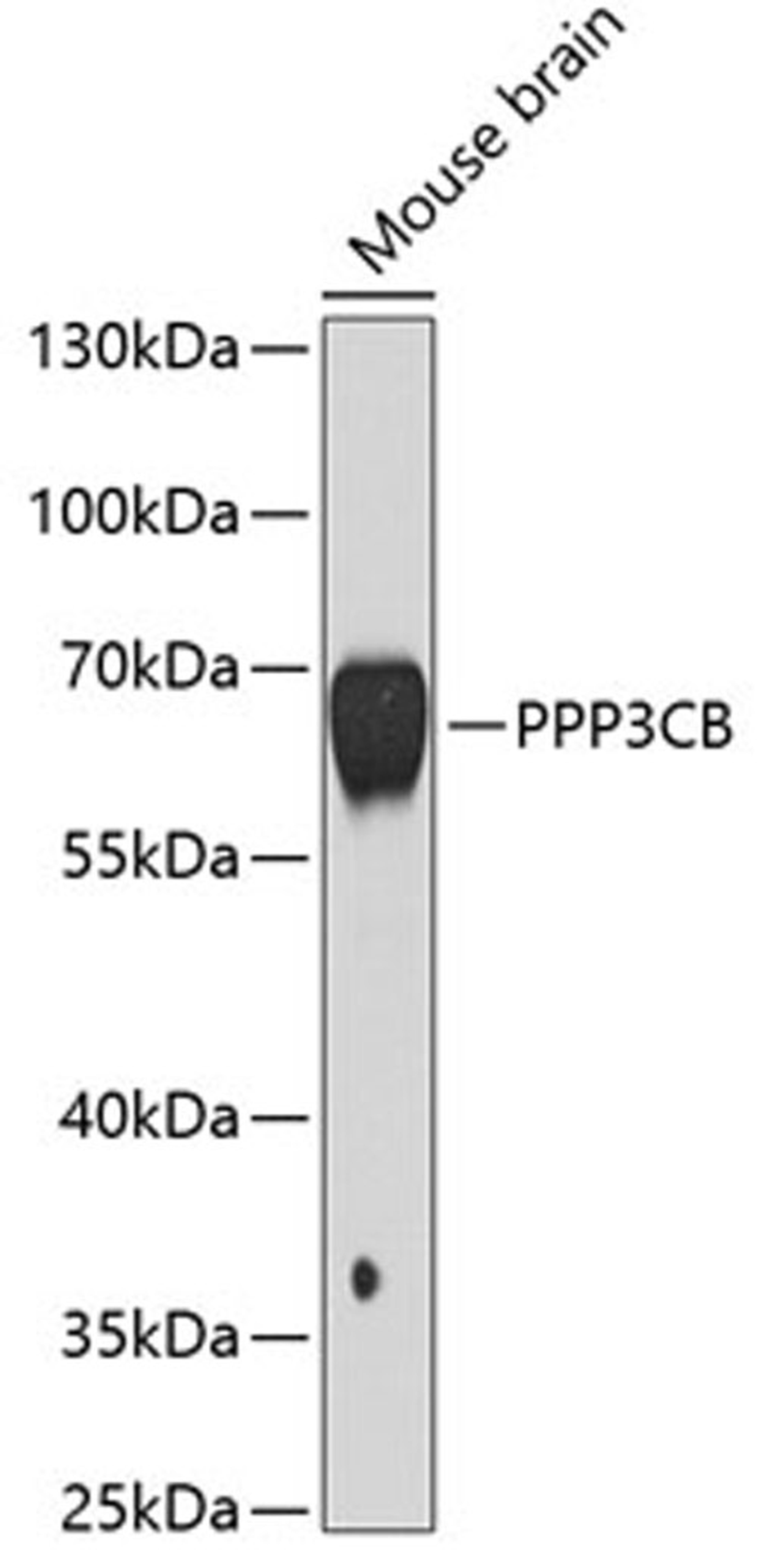 Western blot - PPP3CB antibody (A3629)