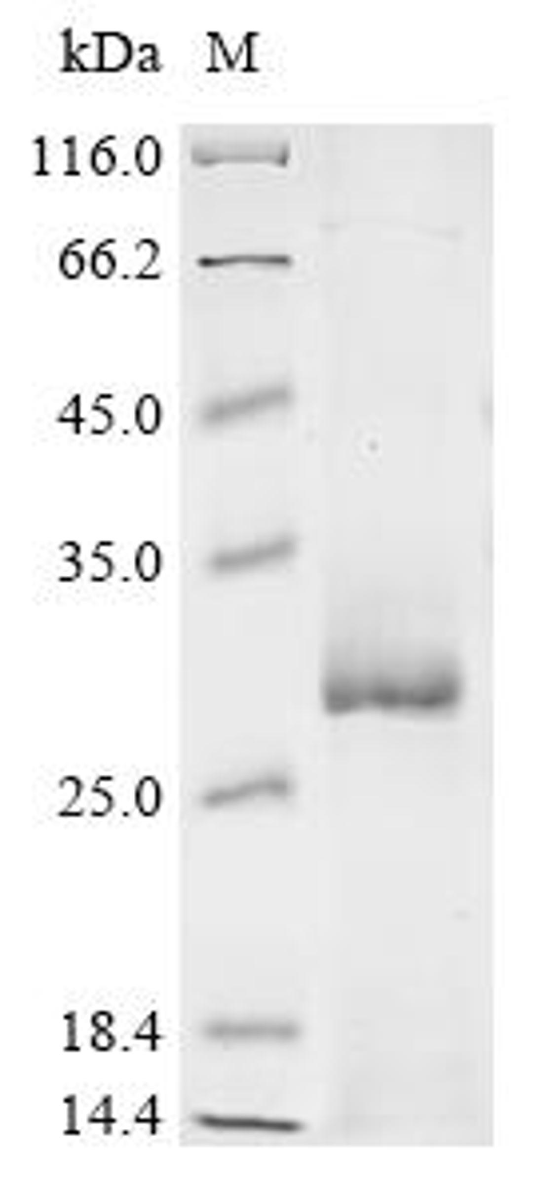 (Tris-Glycine gel) Discontinuous SDS-PAGE (reduced) with 5% enrichment gel and 15% separation gel.