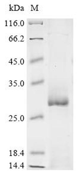 (Tris-Glycine gel) Discontinuous SDS-PAGE (reduced) with 5% enrichment gel and 15% separation gel.