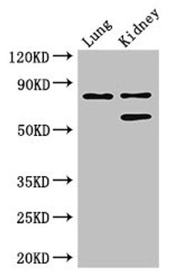 Western Blot. Positive WB detected in: Mouse lung tissue, Mouse kidney tissue. All lanes: LEPREL1 antibody at 3ug/ml. Secondary. Goat polyclonal to rabbit IgG at 1/50000 dilution. Predicted band size: 81, 61 kDa. Observed band size: 81, 61 kDa. 
