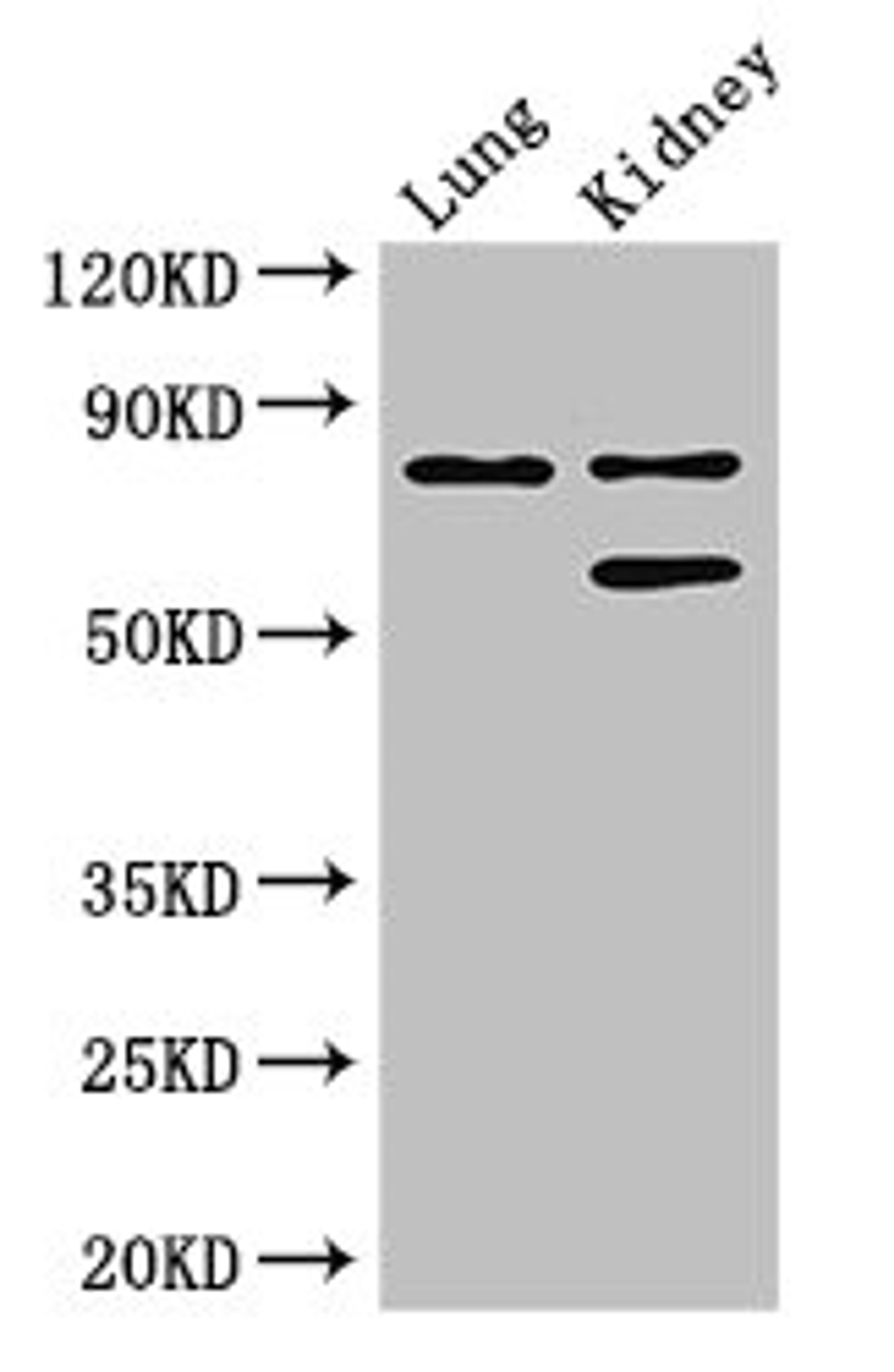 Western Blot. Positive WB detected in: Mouse lung tissue, Mouse kidney tissue. All lanes: LEPREL1 antibody at 3ug/ml. Secondary. Goat polyclonal to rabbit IgG at 1/50000 dilution. Predicted band size: 81, 61 kDa. Observed band size: 81, 61 kDa. 