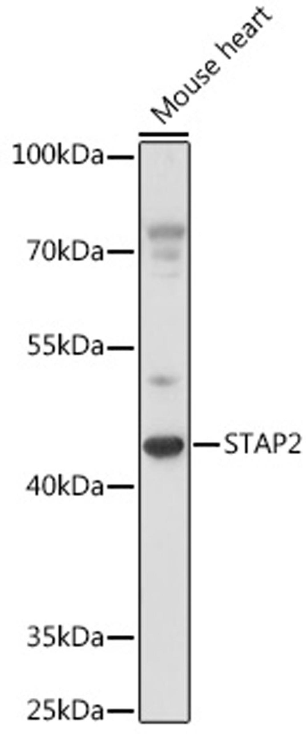 Western blot - STAP2 antibody (A16131)