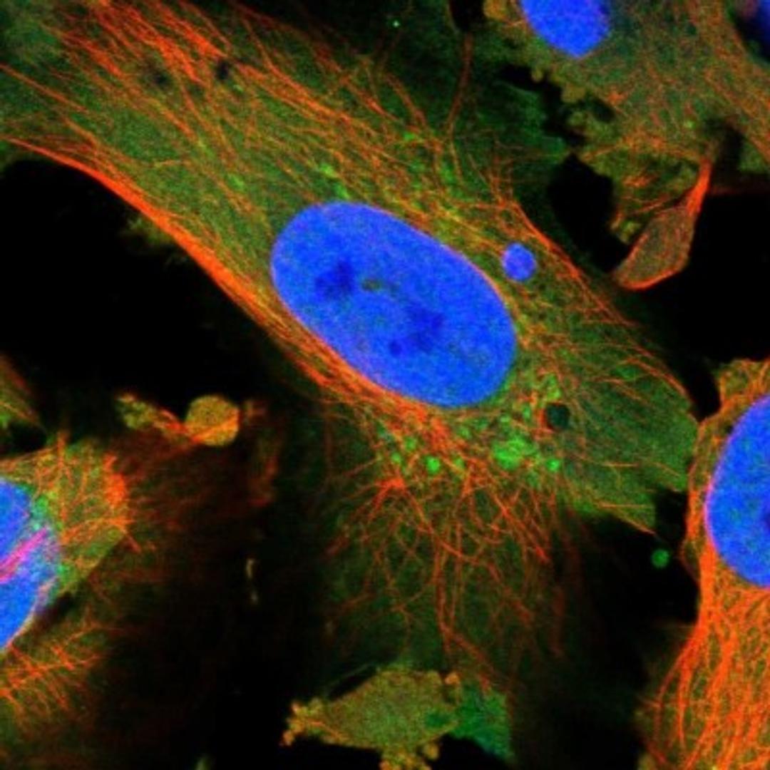 Immunocytochemistry/Immunofluorescence: NARS2 Antibody [NBP1-82077] - Staining of human cell line U-251MG shows positivity in nucleus but not nucleoli, cytoplasm & mitochondria.