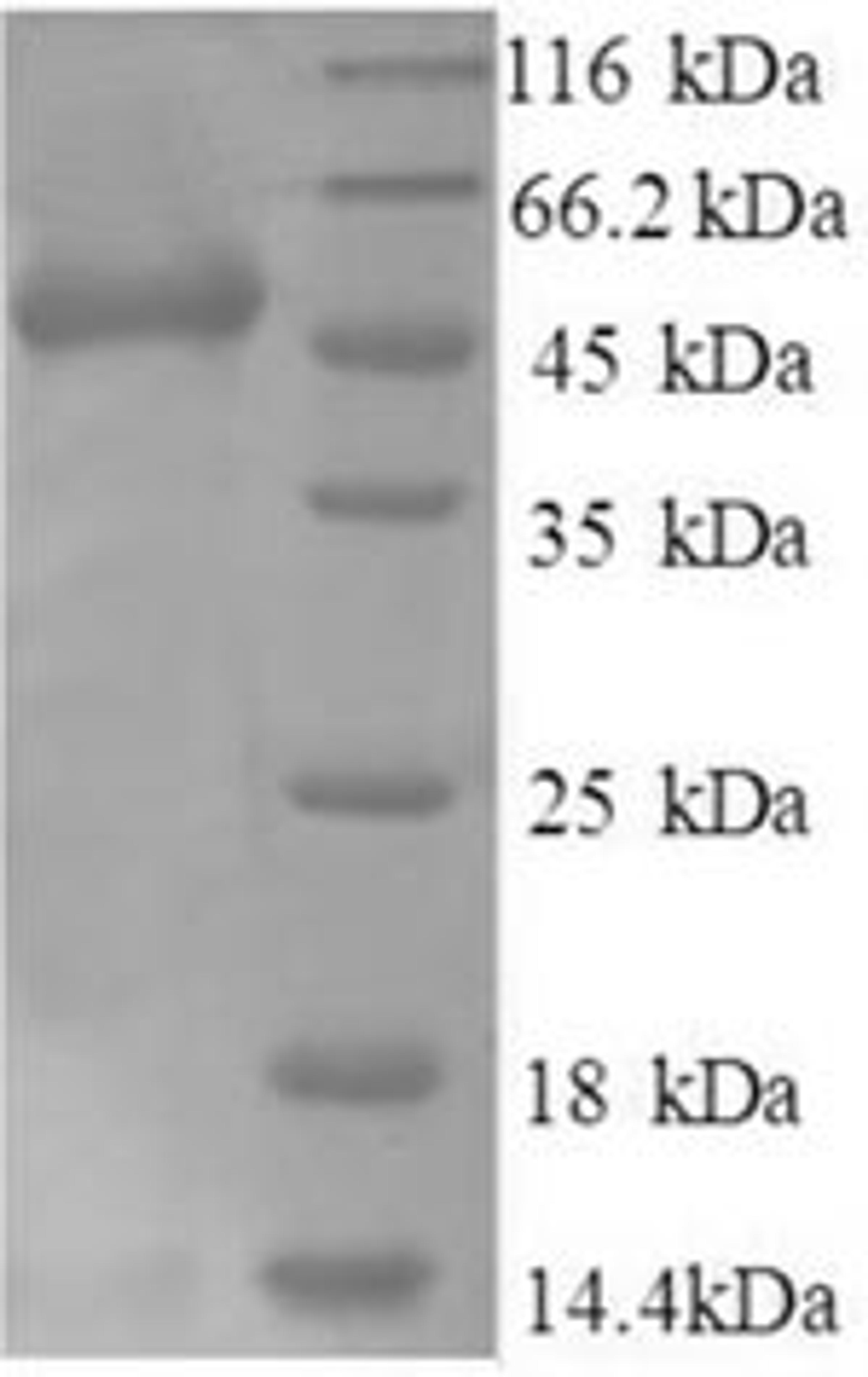 (Tris-Glycine gel) Discontinuous SDS-PAGE (reduced) with 5% enrichment gel and 15% separation gel.