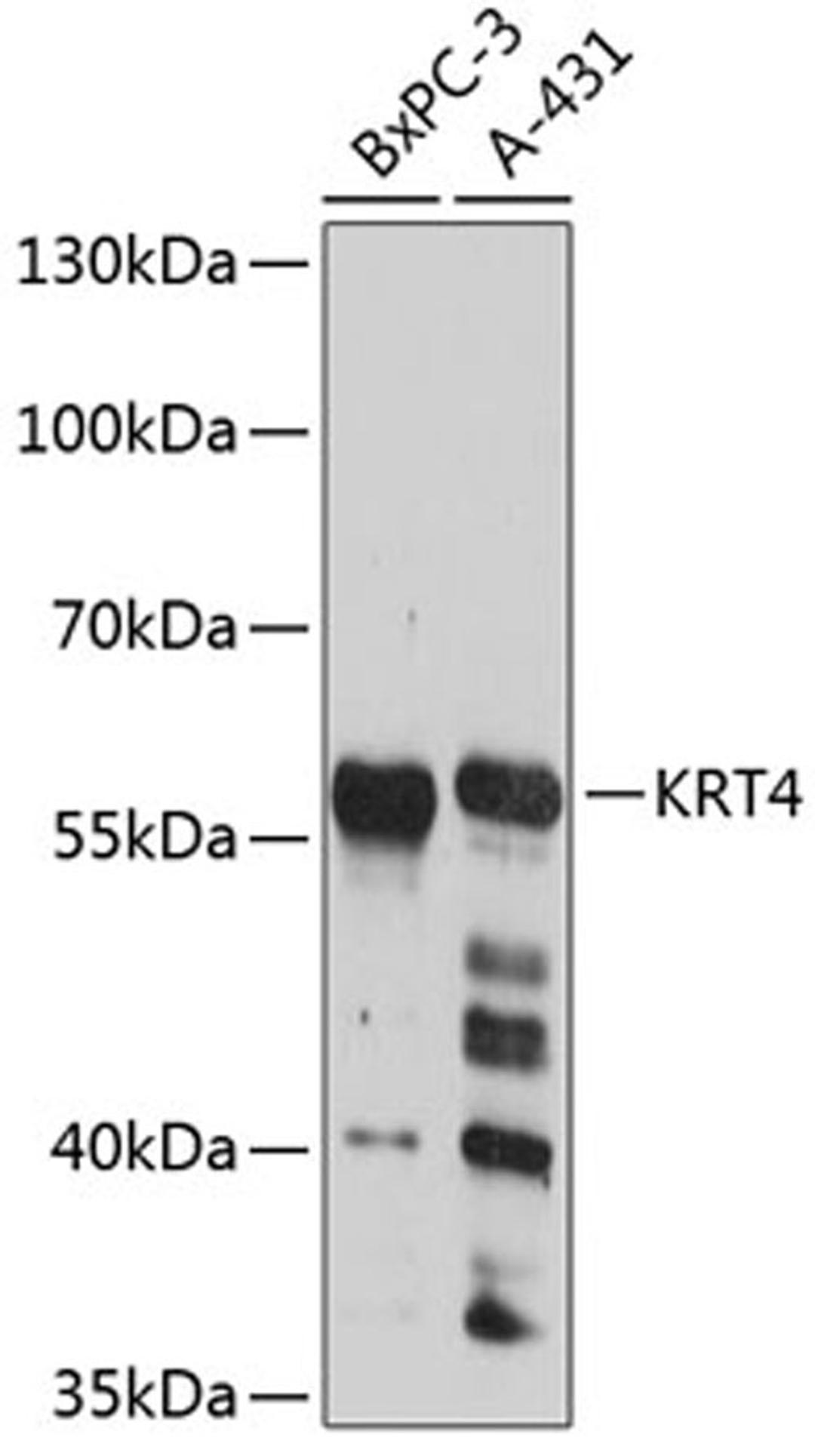 Western blot - KRT4 antibody (A12156)