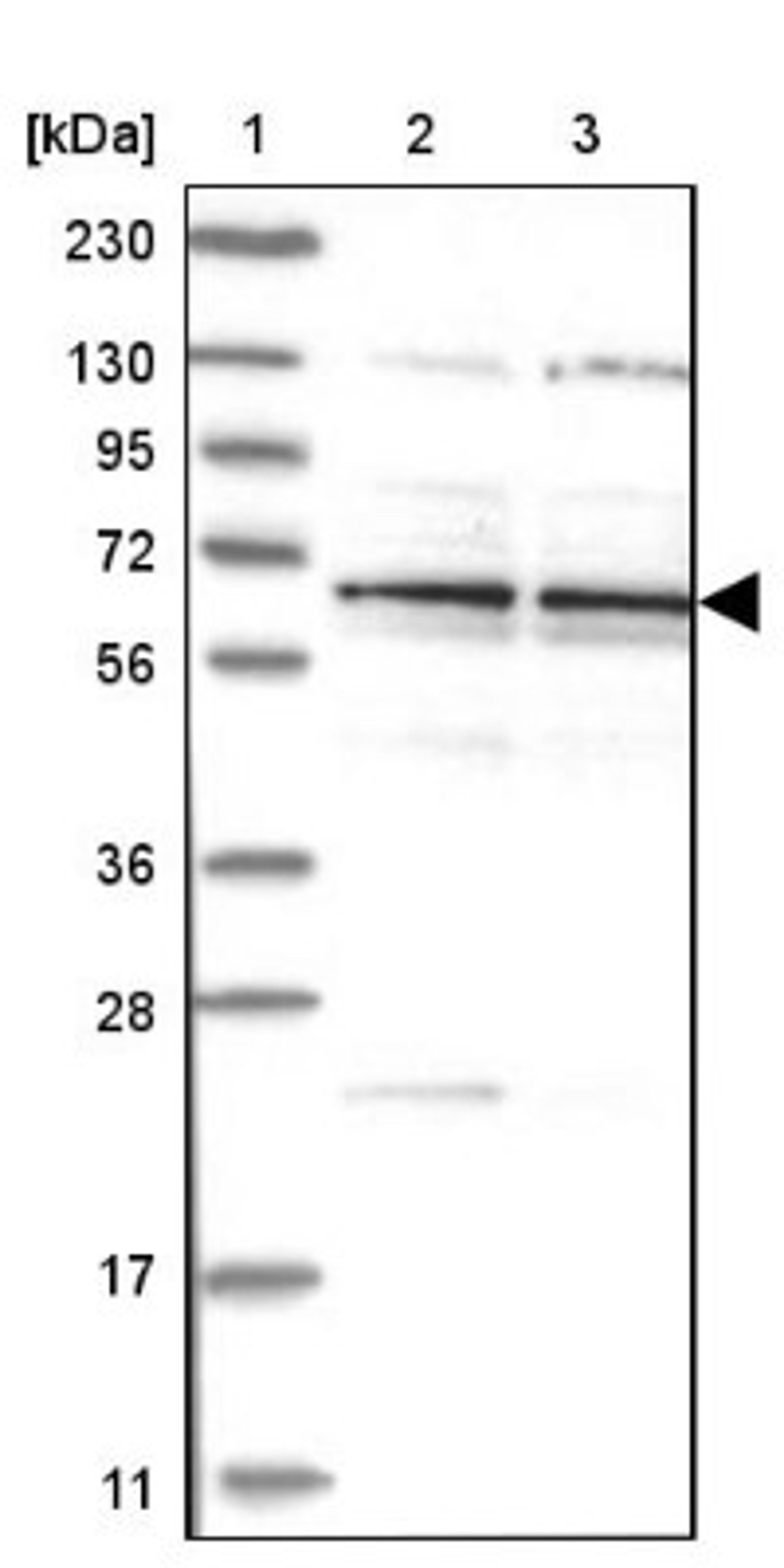 Western Blot: Zinc finger protein 324B Antibody [NBP1-92614] - Lane 1: Marker [kDa] 230, 130, 95, 72, 56, 36, 28, 17, 11<br/>Lane 2: Human cell line RT-4<br/>Lane 3: Human cell line U-251MG sp