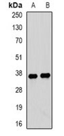 Western blot analysis of mouse lung (Lane1), mouse heart (Lane2) whole cell lysates using TPM3 antibody