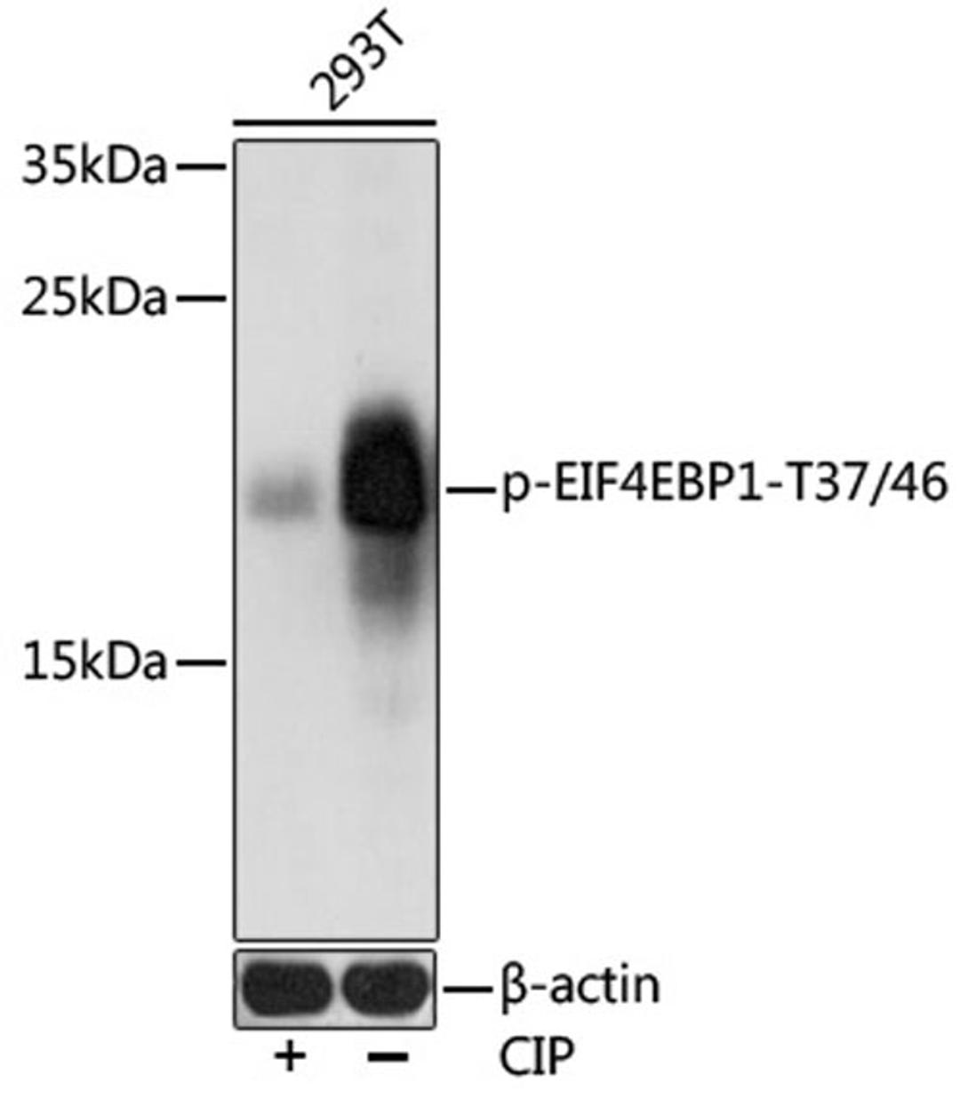 Western blot - Phospho-EIF4EBP1-T37/46 antibody (AP0030)