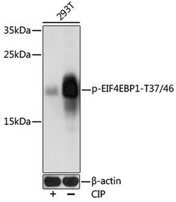 Western blot - Phospho-EIF4EBP1-T37/46 antibody (AP0030)