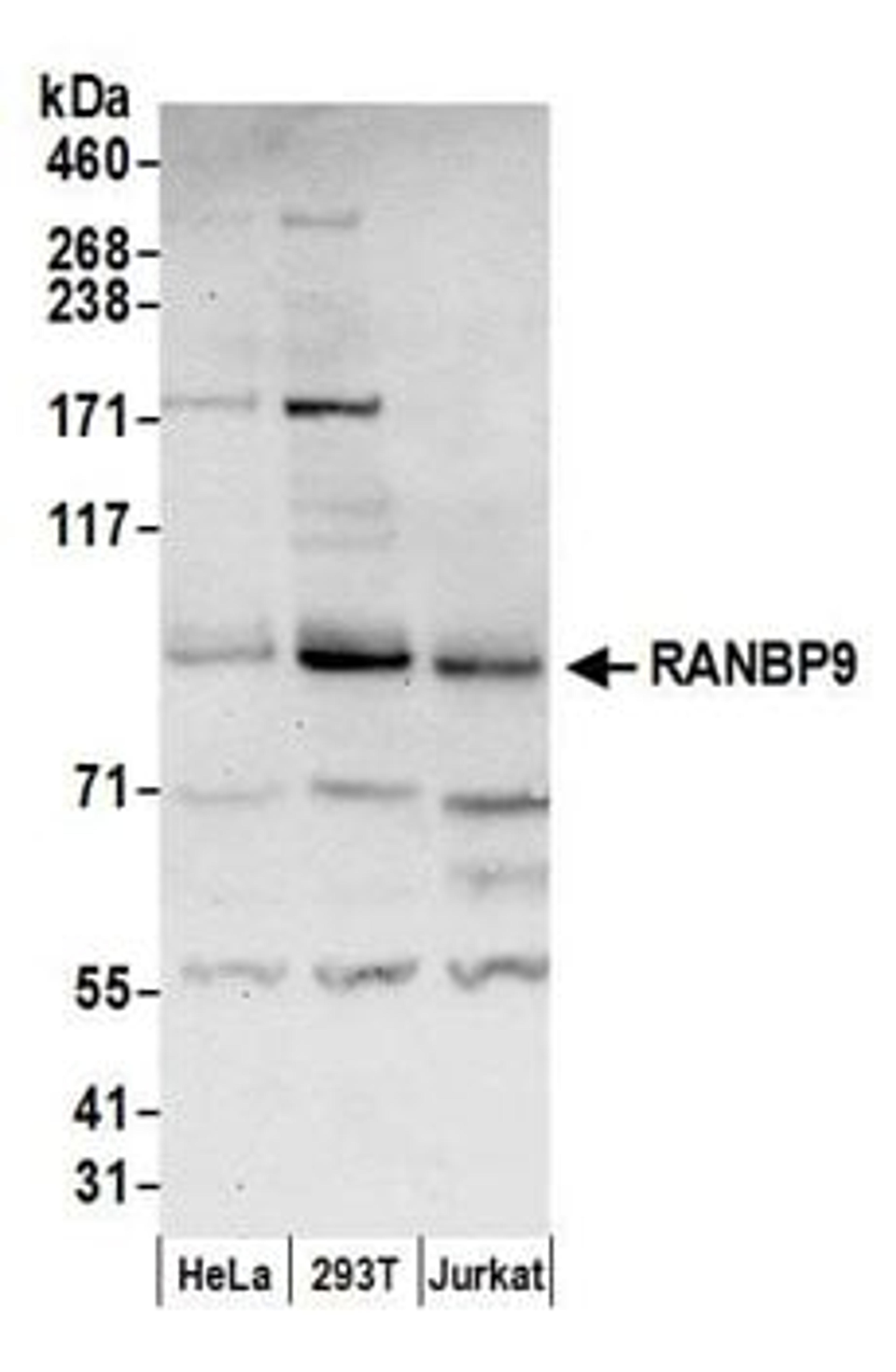 Detection of human RANBP9 by western blot.