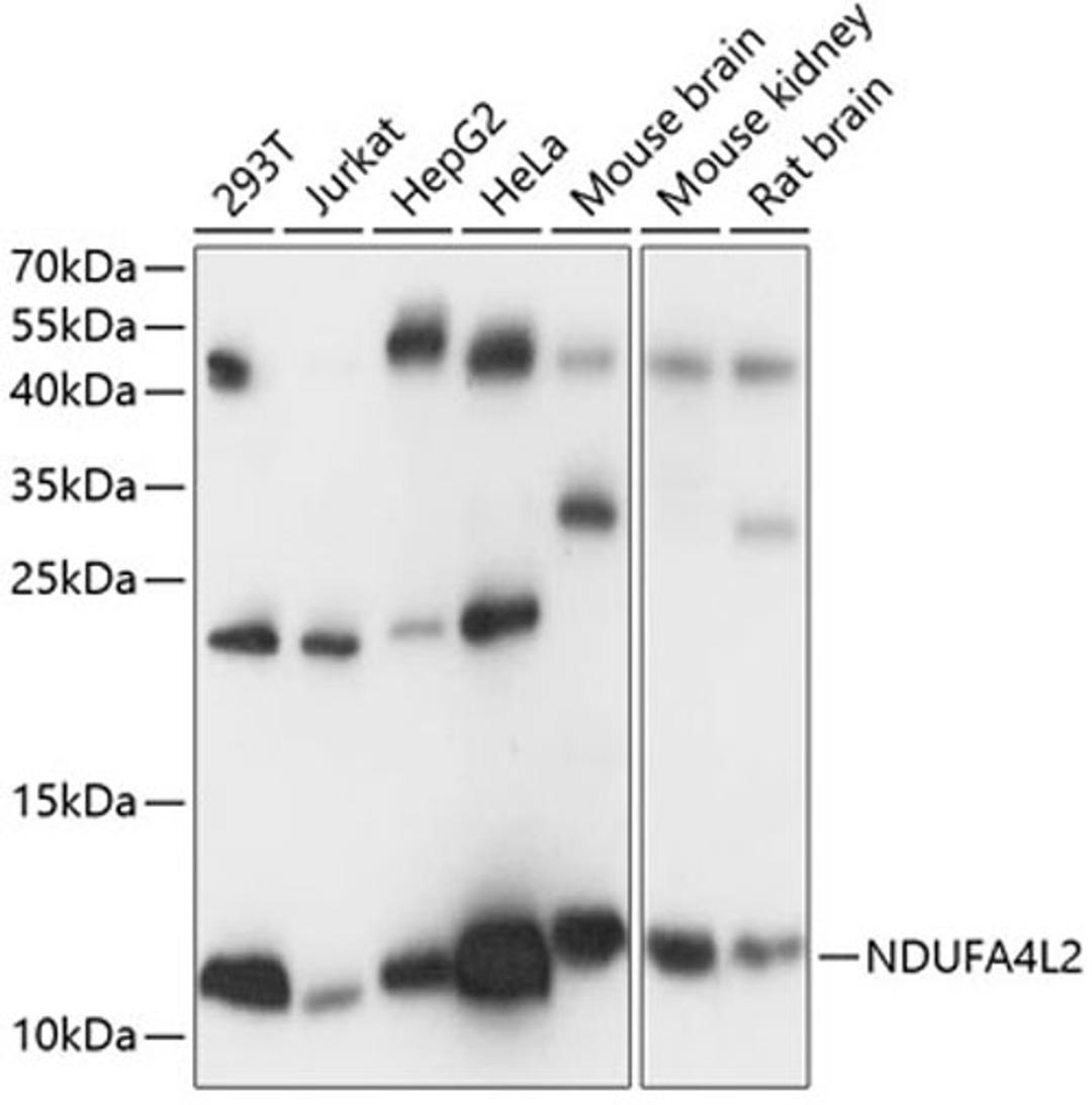 Western blot - NDUFA4L2 antibody (A14288)