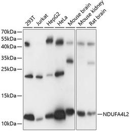 Western blot - NDUFA4L2 antibody (A14288)