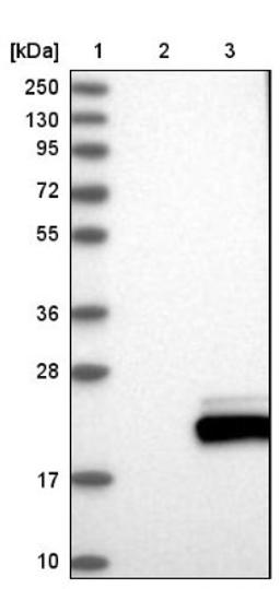 Western Blot: Ube2L6 Antibody [NBP1-86885] - Lane 1: Marker [kDa] 250, 130, 95, 72, 55, 36, 28, 17, 10<br/>Lane 2: Negative control (vector only transfected HEK293T lysate)<br/>Lane 3: Over-expression lysate (Co-expressed with a C-terminal myc-DDK tag (~3.1 kDa) in mammalian HEK293T cells, LY404883)