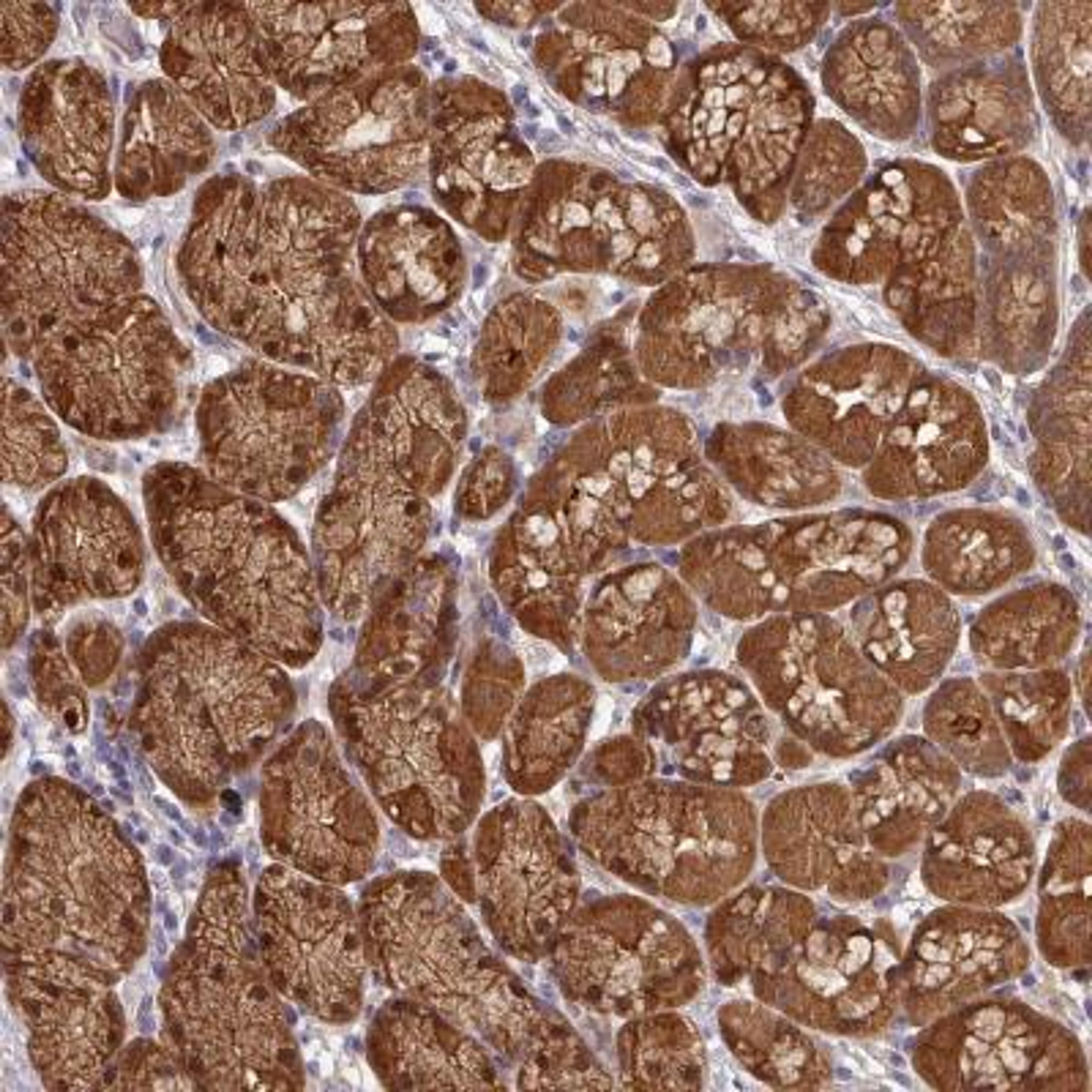 Immunohistochemistry: SPDYE2 Antibody [NBP2-46794] - Analysis of human stomach, upper shows moderate cytoplasmic and nuclear positivity in glandular cells.