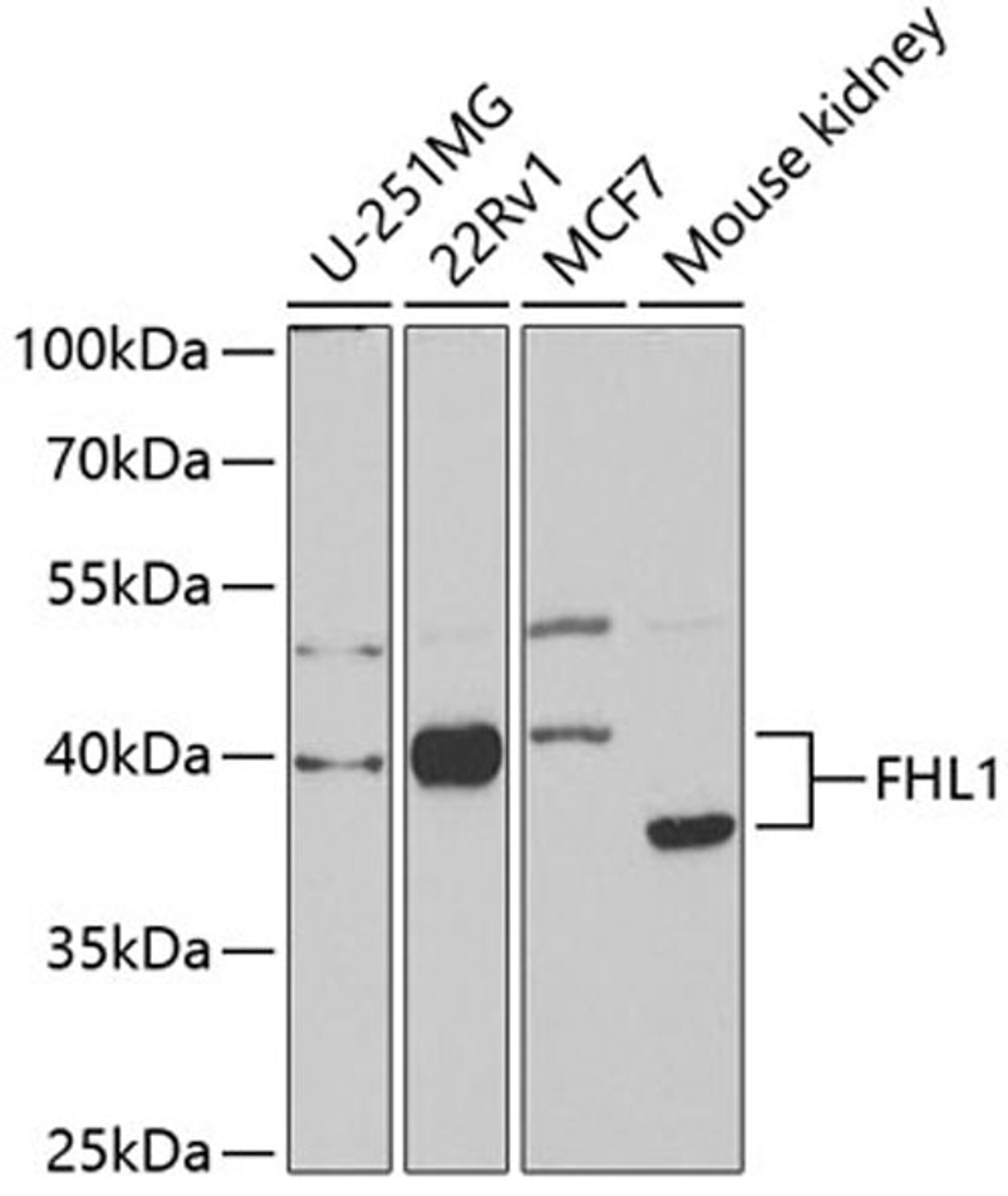 Western blot - FHL1 antibody (A5460)