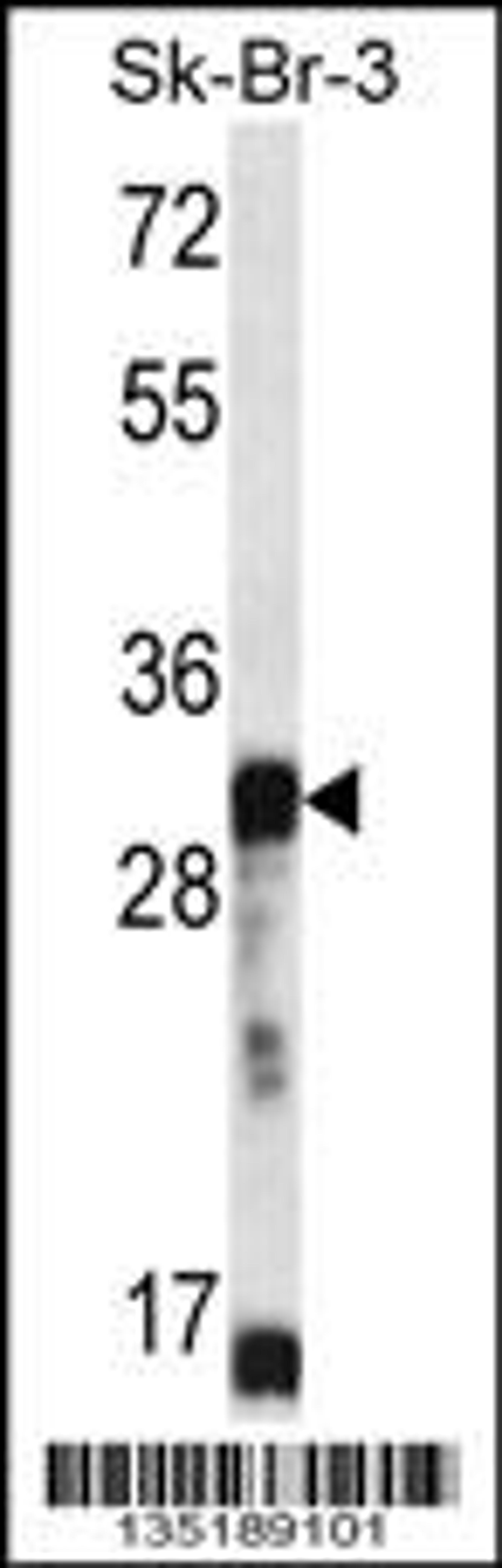 Western blot analysis in SK-BR-3 cell line lysates (35ug/lane).