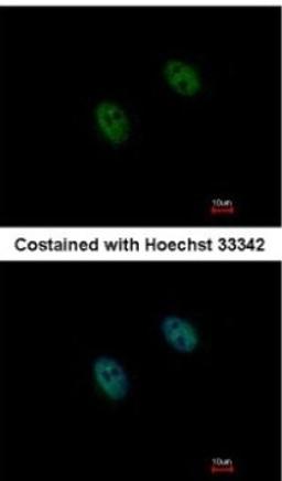 Immunocytochemistry/Immunofluorescence: DUSP2 Antibody [NBP2-14934] - Paraformaldehyde-fixed HeLa, using DUSP2/PAC1 antibody at 1:1000 dilution.