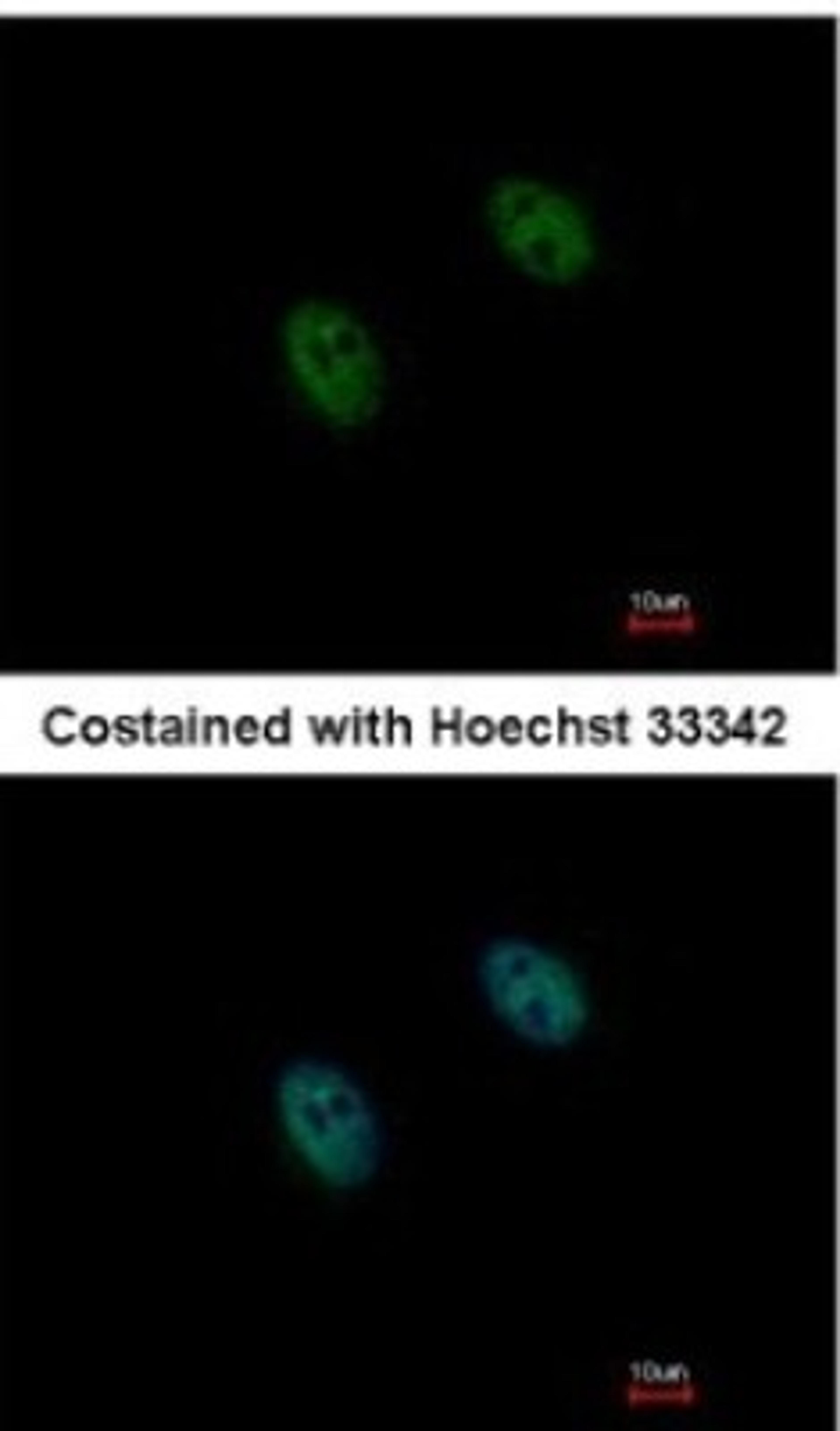 Immunocytochemistry/Immunofluorescence: DUSP2 Antibody [NBP2-14934] - Paraformaldehyde-fixed HeLa, using DUSP2/PAC1 antibody at 1:1000 dilution.