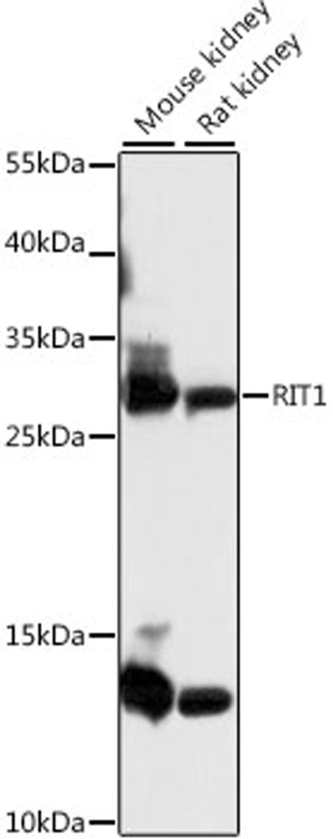 Western blot - RIT1 antibody (A15715)