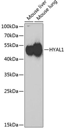 Western blot - HYAL1 Antibody (A6623)