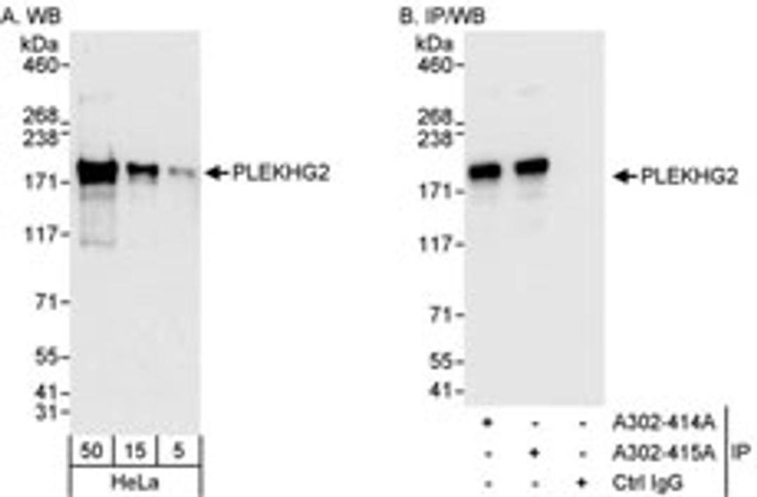 Detection of human PLEKHG2 by western blot and immunoprecipitation.