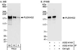 Detection of human PLEKHG2 by western blot and immunoprecipitation.