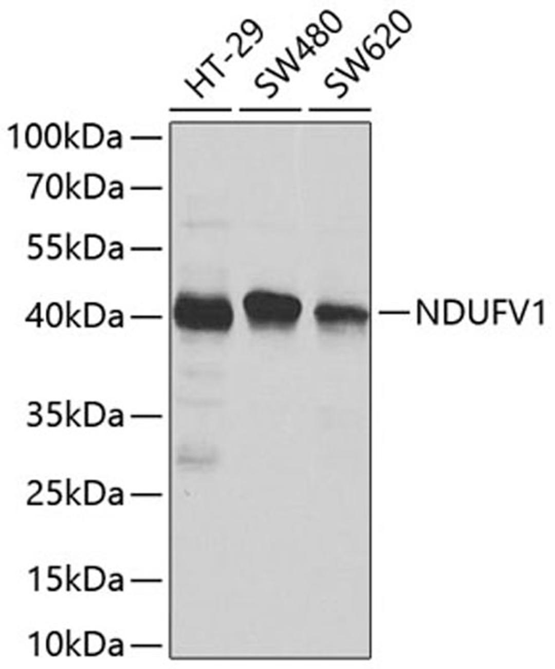 Western blot - NDUFV1 antibody (A8014)