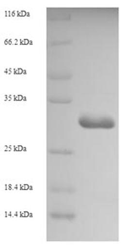(Tris-Glycine gel) Discontinuous SDS-PAGE (reduced) with 5% enrichment gel and 15% separation gel.