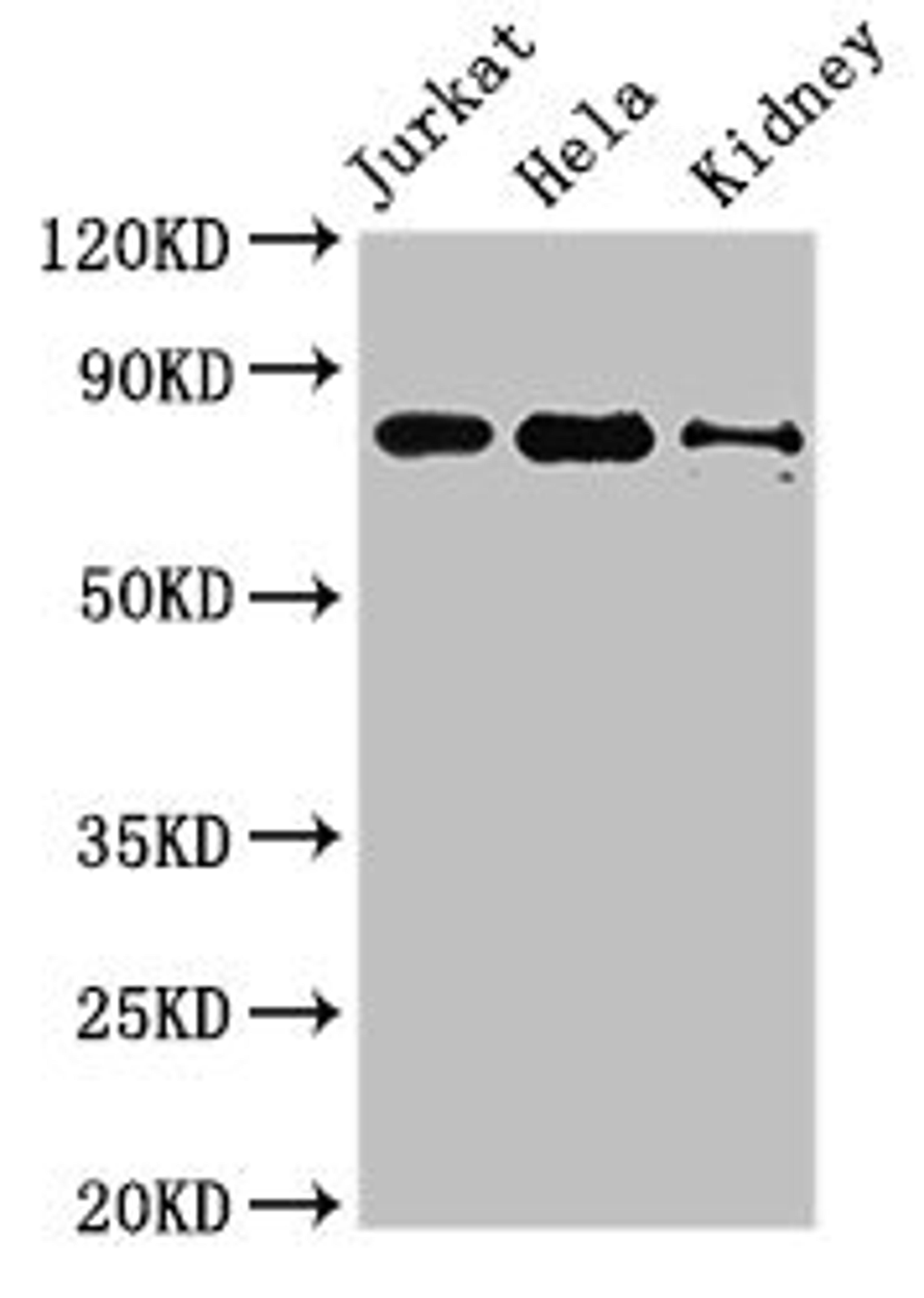 Western Blot. Positive WB detected in: Jurkat whole cell lysate, Hela whole cell lysate, Mouse kidney tissue. All lanes: NOA1 antibody at 3.4µg/ml. Secondary. Goat polyclonal to rabbit IgG at 1/50000 dilution. Predicted band size: 79 kDa. Observed band size: 79 kDa