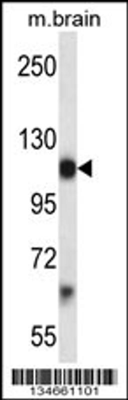 Western blot analysis in mouse brain tissue lysates (35ug/lane).