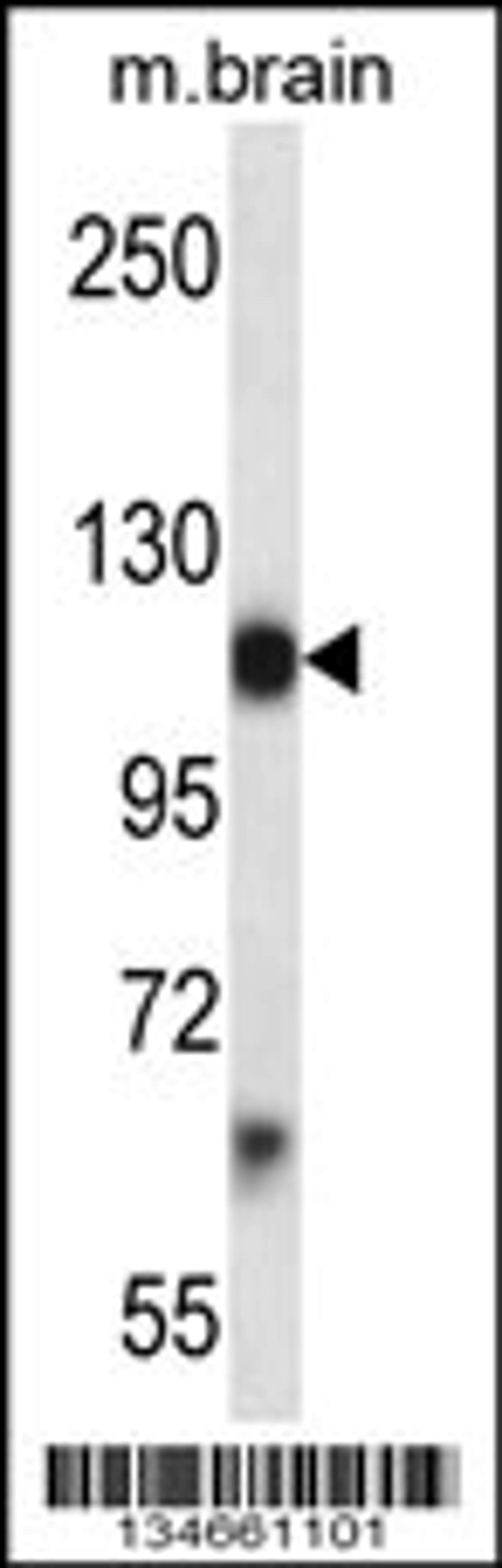 Western blot analysis in mouse brain tissue lysates (35ug/lane).