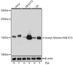 Western blot - Acetyl-Histone H2B-K15 antibody (A15622)