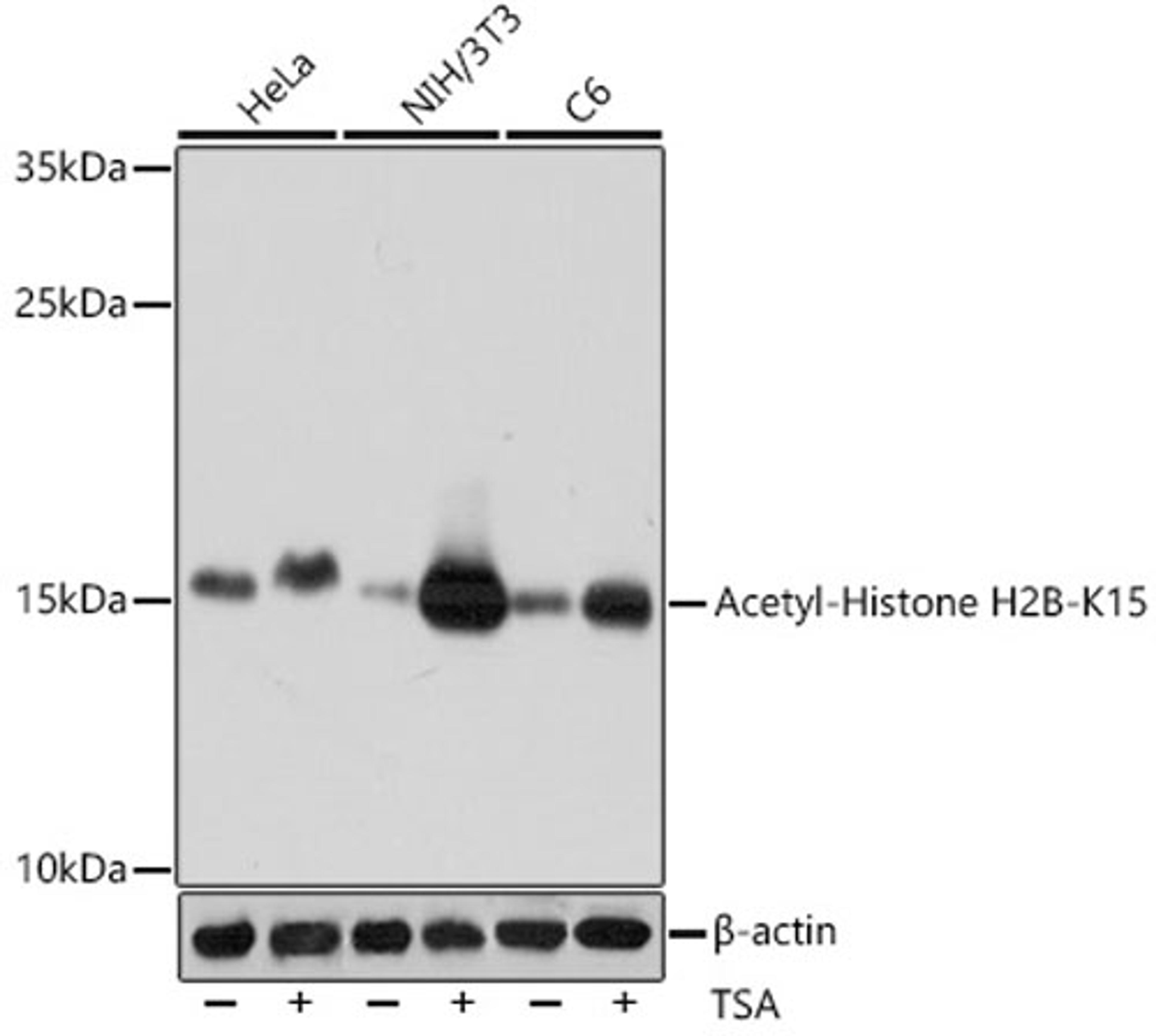 Western blot - Acetyl-Histone H2B-K15 antibody (A15622)