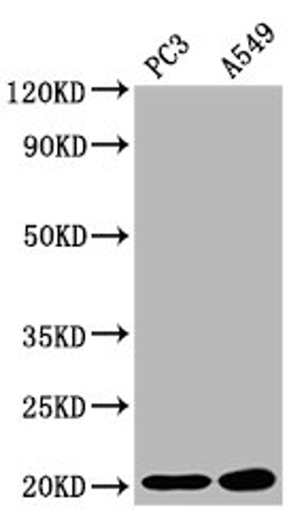 Western Blot. Positive WB detected in: PC-3 whole cell lysate, A549 whole cell lysate. All lanes: SNX12 antibody at 2.83µg/ml. Secondary. Goat polyclonal to rabbit IgG at 1/50000 dilution. Predicted band size: 20, 19 kDa. Observed band size: 20 kDa