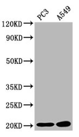 Western Blot. Positive WB detected in: PC-3 whole cell lysate, A549 whole cell lysate. All lanes: SNX12 antibody at 2.83µg/ml. Secondary. Goat polyclonal to rabbit IgG at 1/50000 dilution. Predicted band size: 20, 19 kDa. Observed band size: 20 kDa