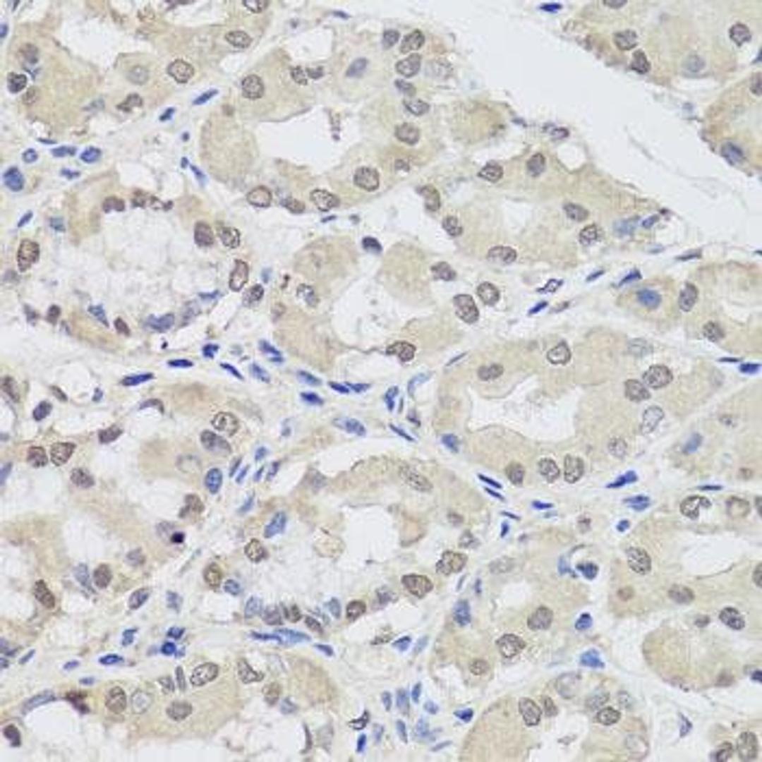 Immunohistochemical staining of human stomach tissue using AGO2 antibody (dilution of 1:100)