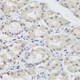 Immunohistochemical staining of human stomach tissue using AGO2 antibody (dilution of 1:100)