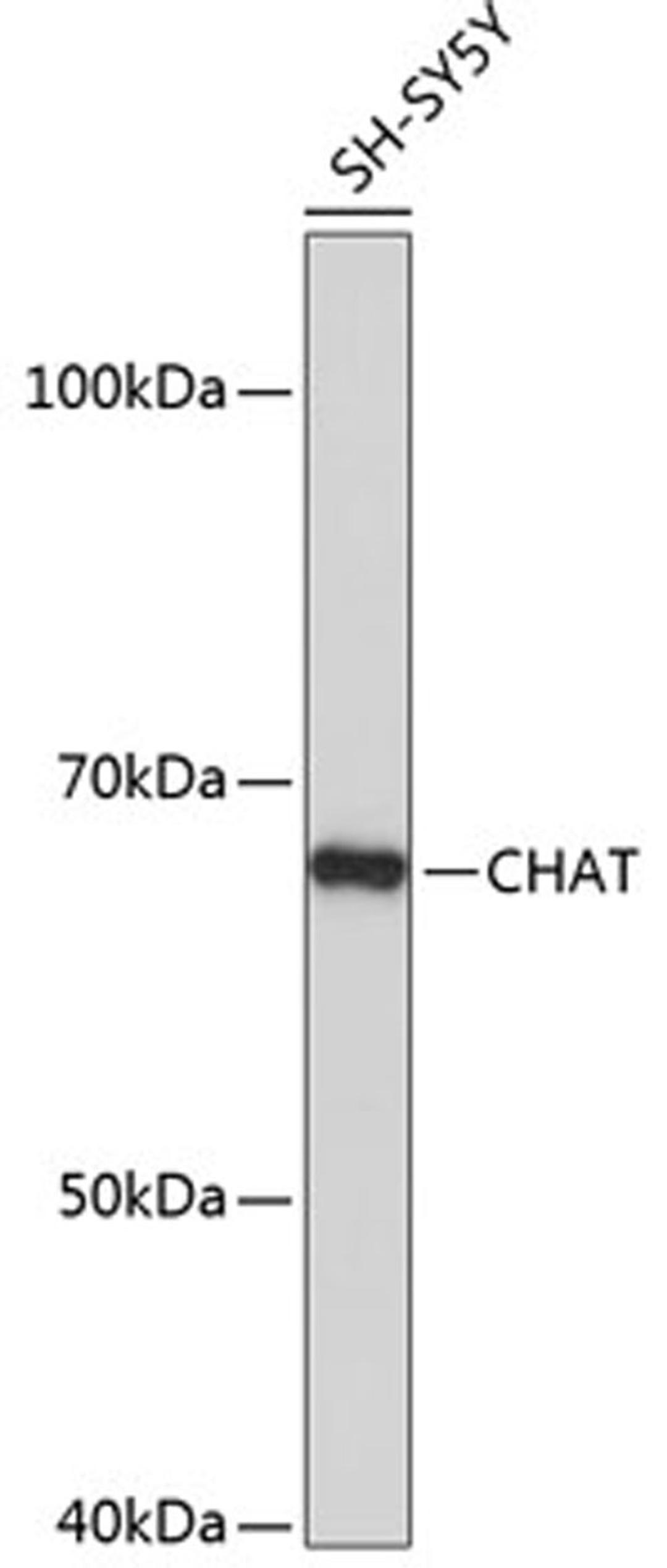 Western blot - CHAT antibody (A19031)