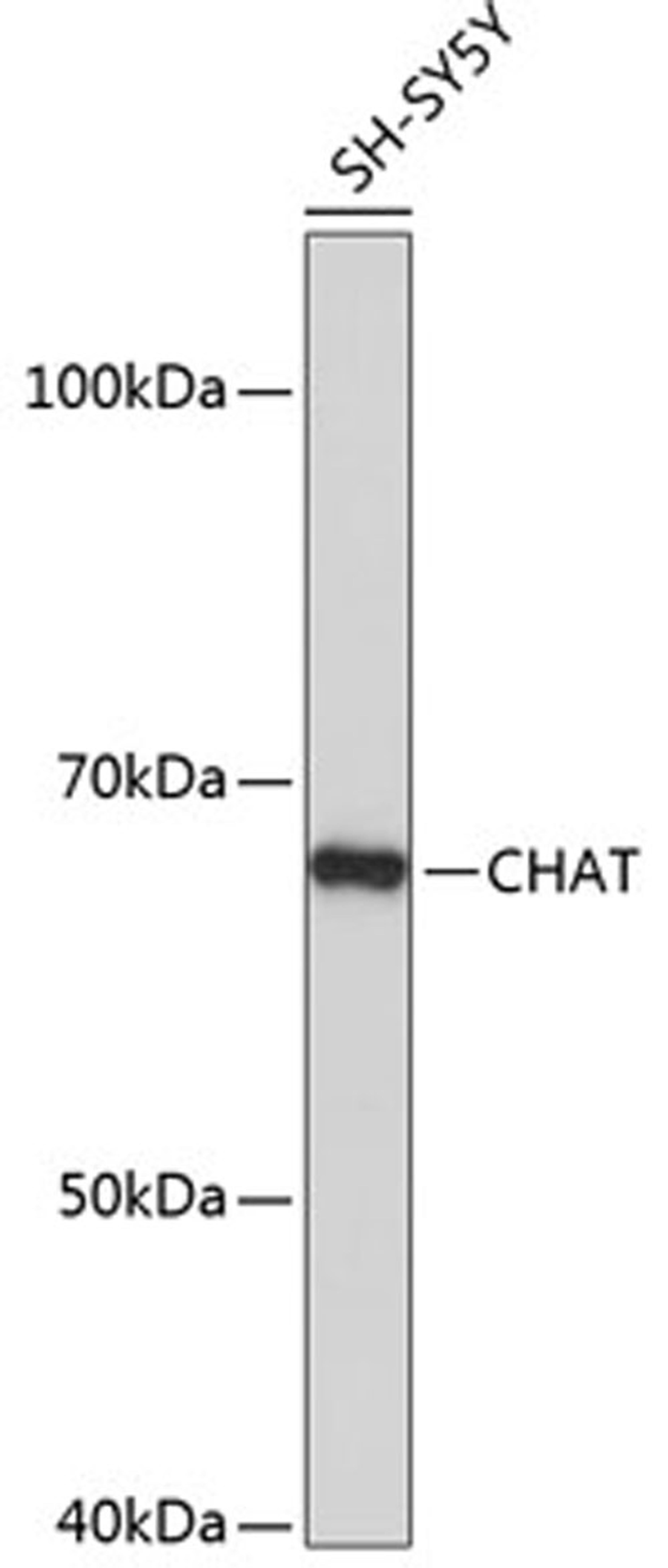 Western blot - CHAT antibody (A19031)