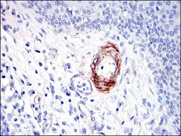 Immunohistochemistry: GKAP/DLGAP1 Antibody (3G4) [NBP2-37582] - Immunohistochemical analysis of paraffin-embedded human esophagus tissues using GKAP mouse mAb with DAB staining.