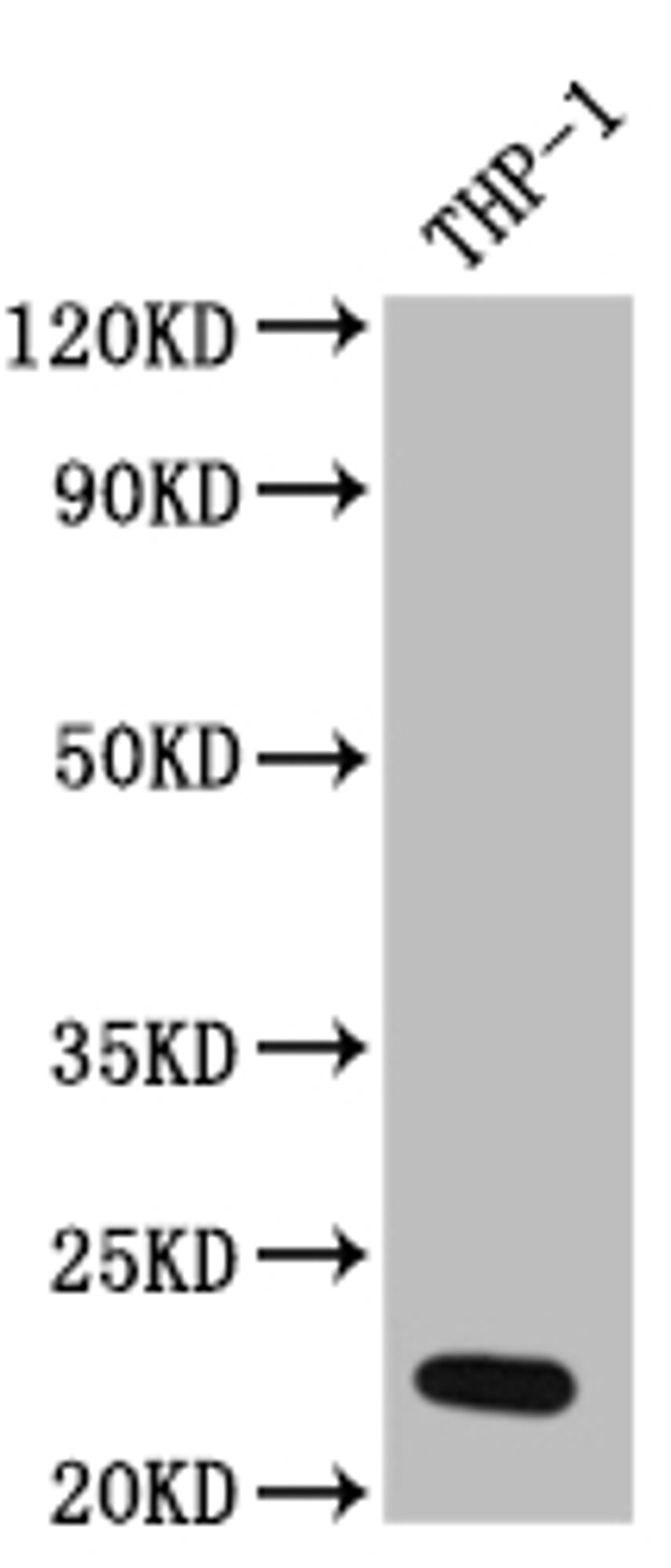 Western Blot. Positive WB detected in: THP-1 whole cell lysate. All lanes: IL23 antibody at 1:1000. Secondary. Goat polyclonal to rabbit IgG at 1/50000 dilution. Predicted band size: 21 kDa. Observed band size: 21 kDa. 