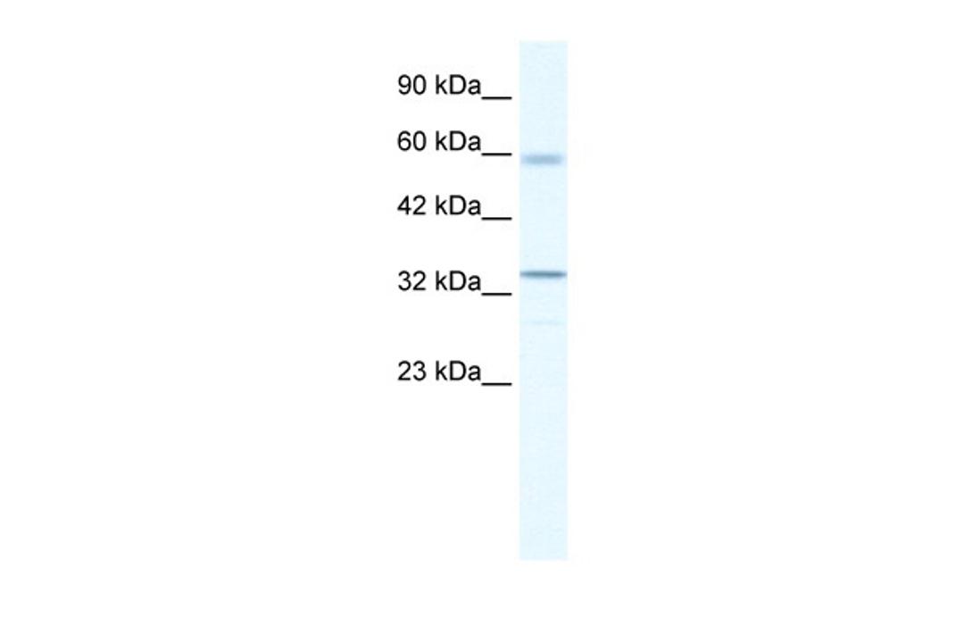 Antibody used in WB on Human HepG2 at 1.25 ug/ml.