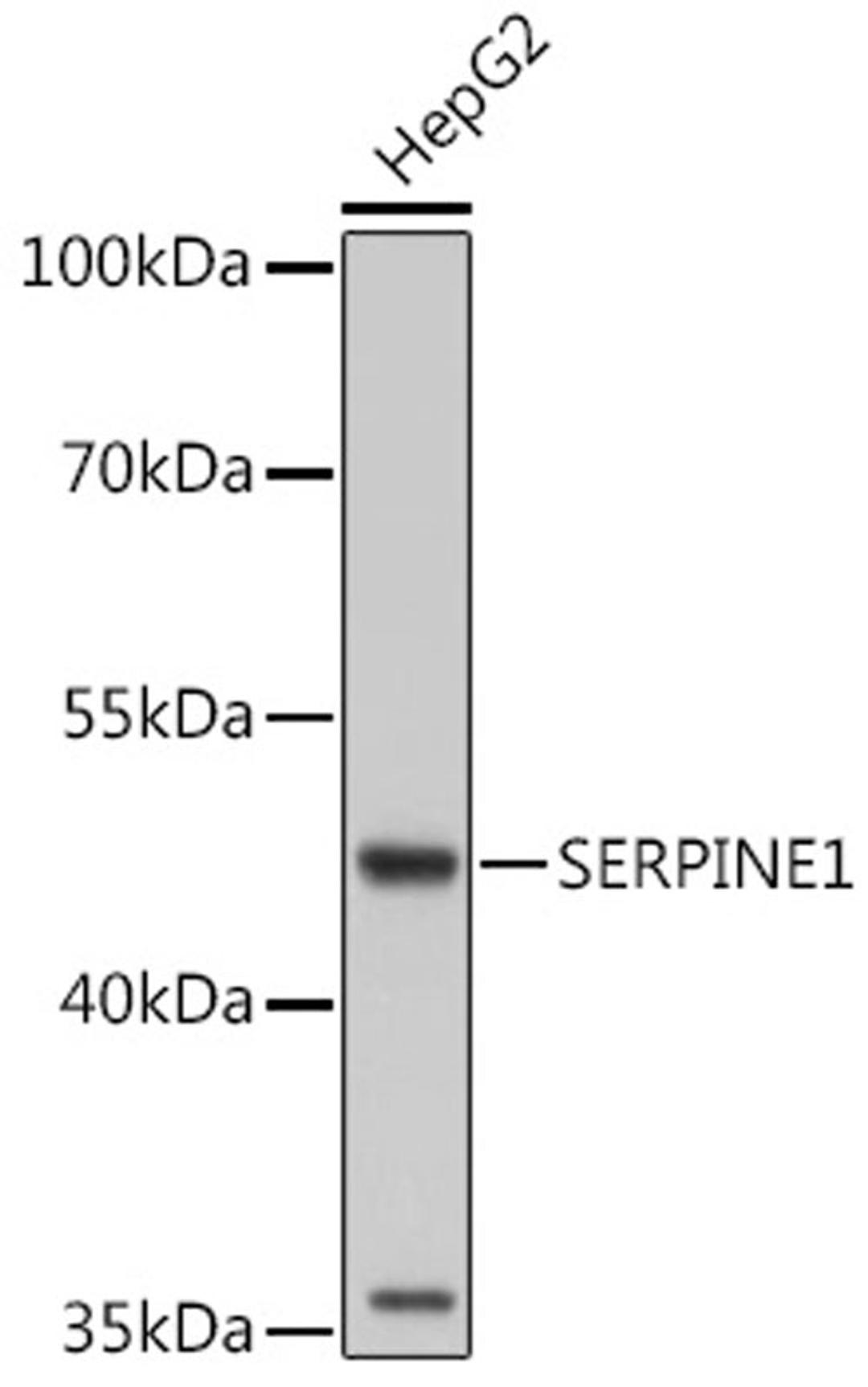 Western blot - SERPINE1 antibody (A6211)