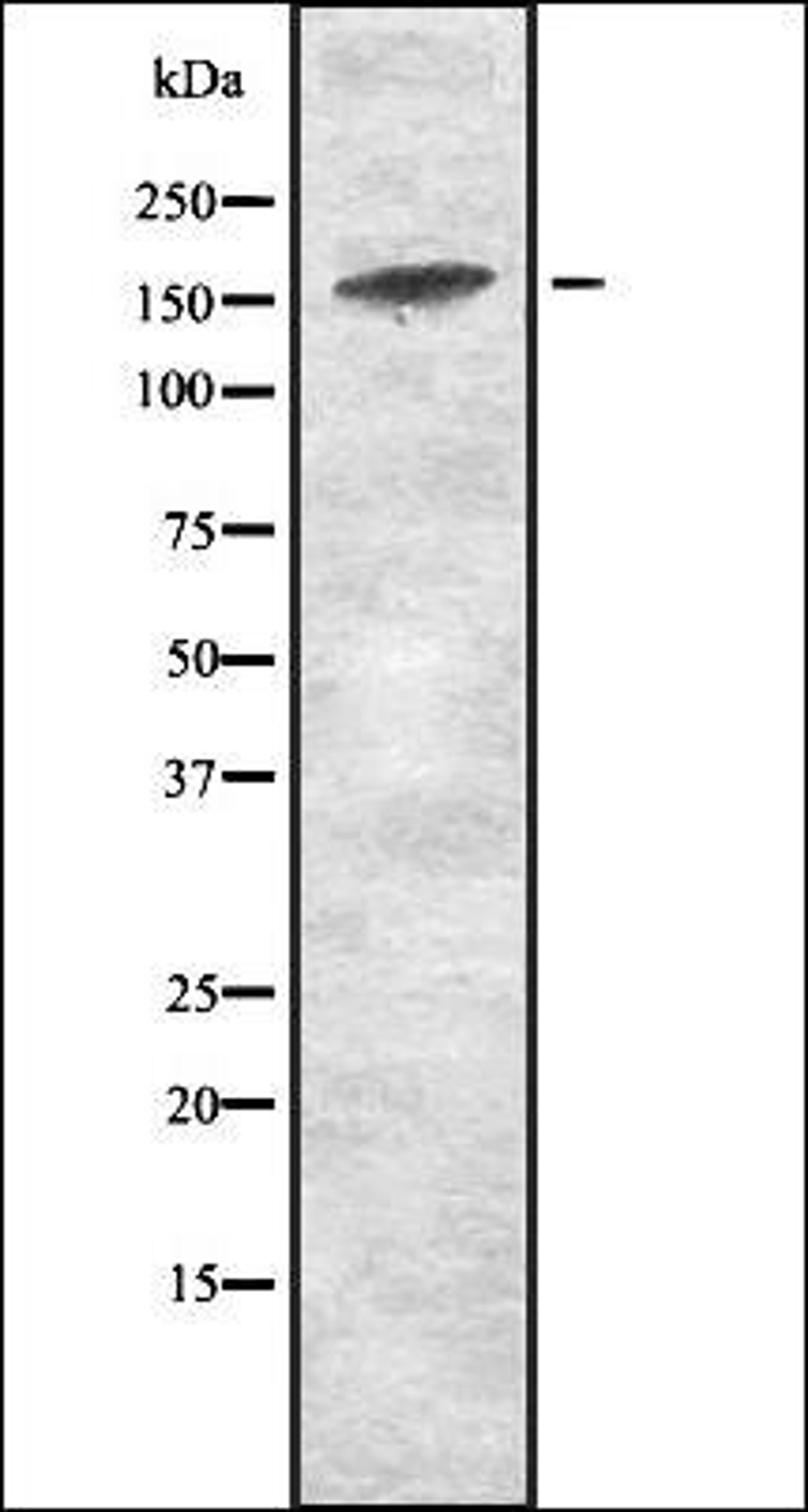 Western blot analysis of HEK293 cells using JAD1D antibody