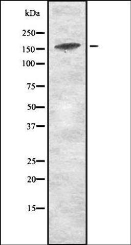 Western blot analysis of HEK293 cells using JAD1D antibody