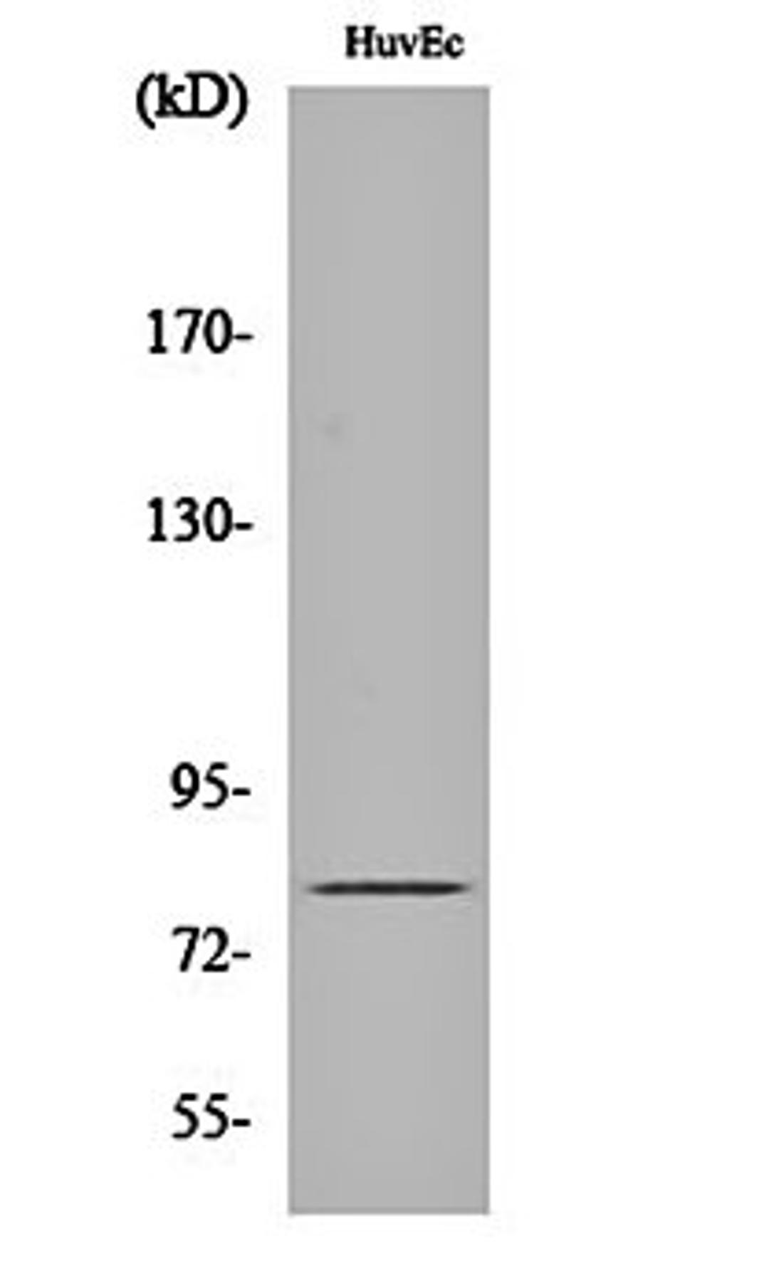 Western blot analysis of HuvEc cell lysates using GRK 2 antibody