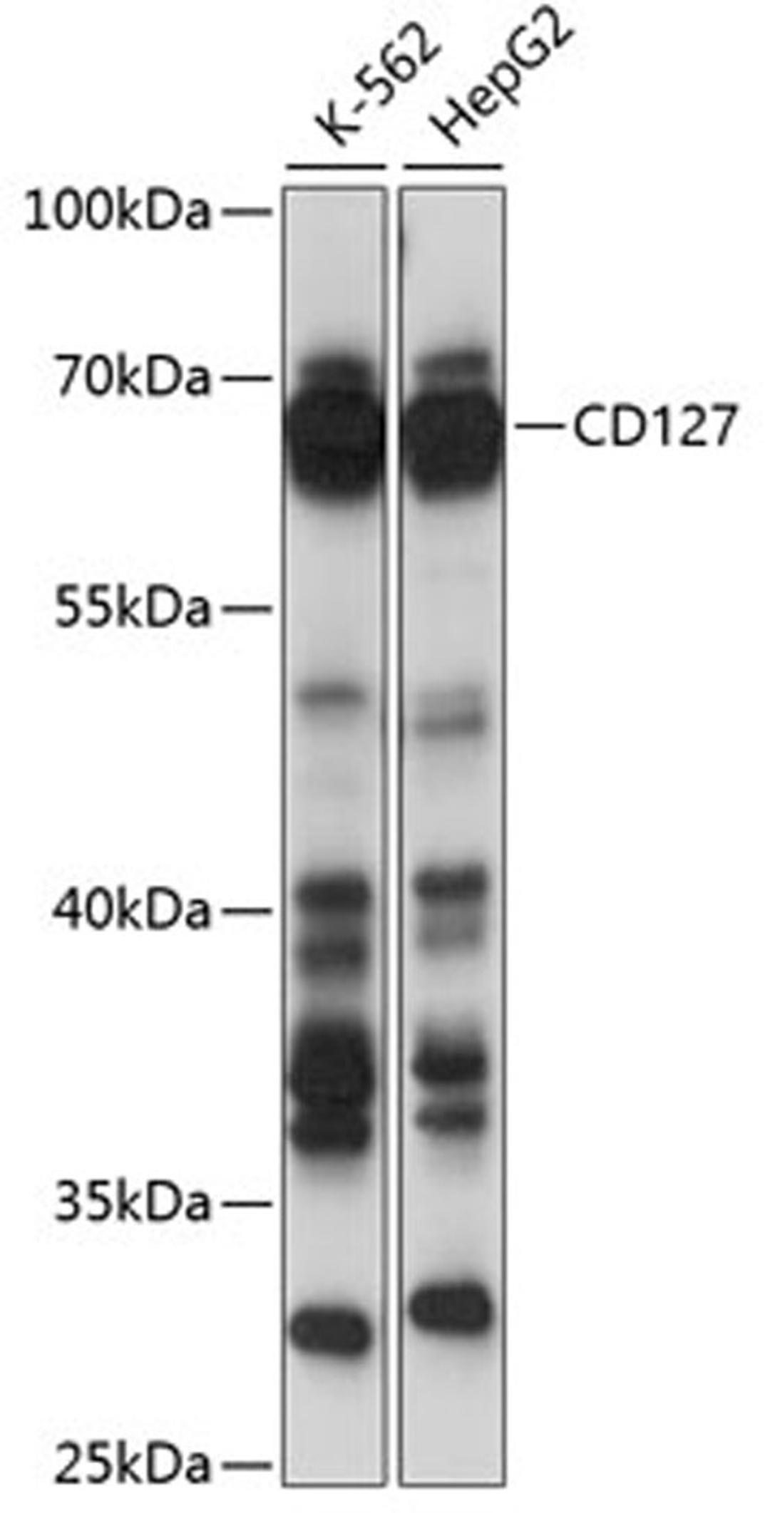 Western blot - CD127 antibody (A13502)