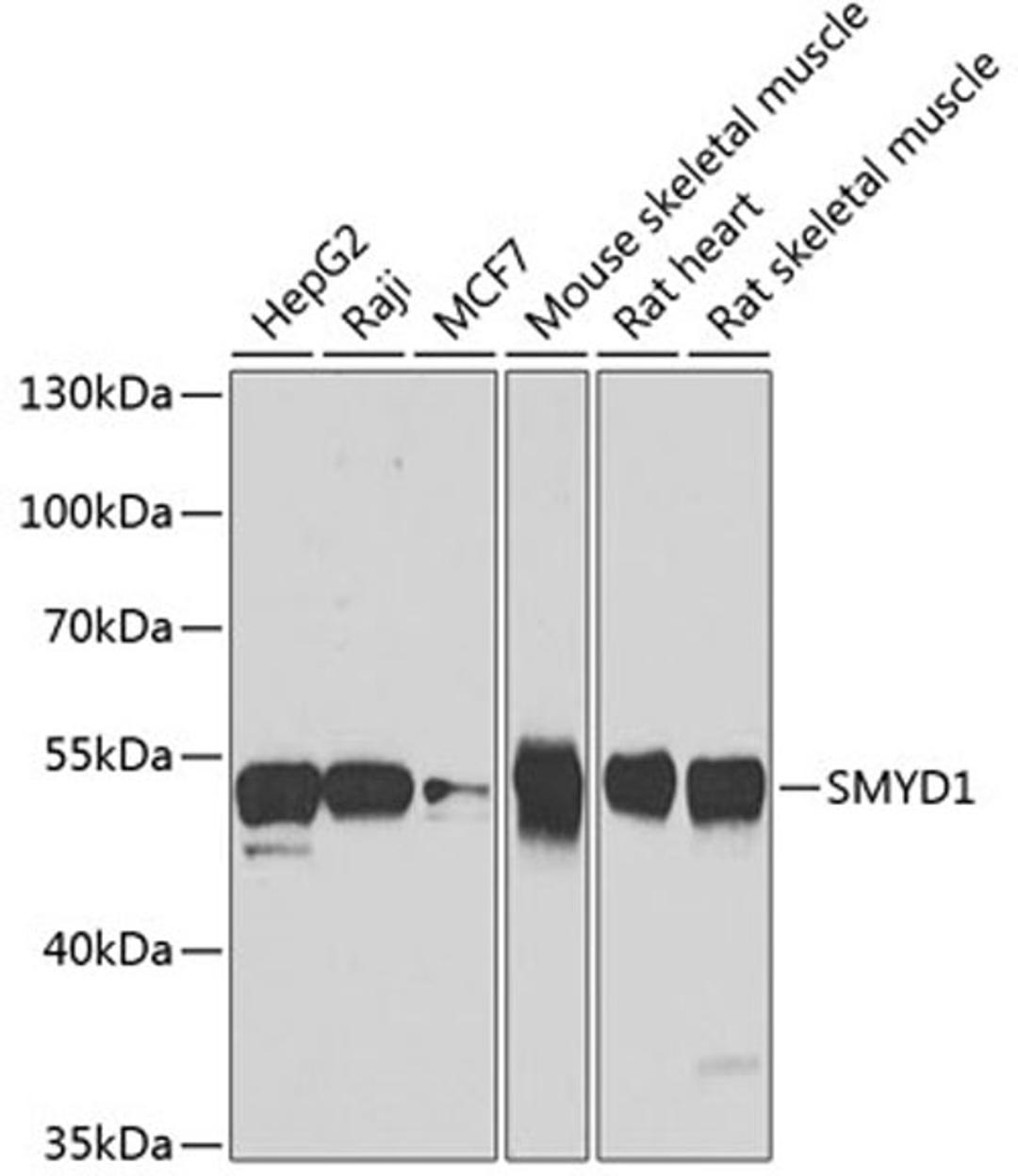 Western blot - SMYD1 antibody (A7308)