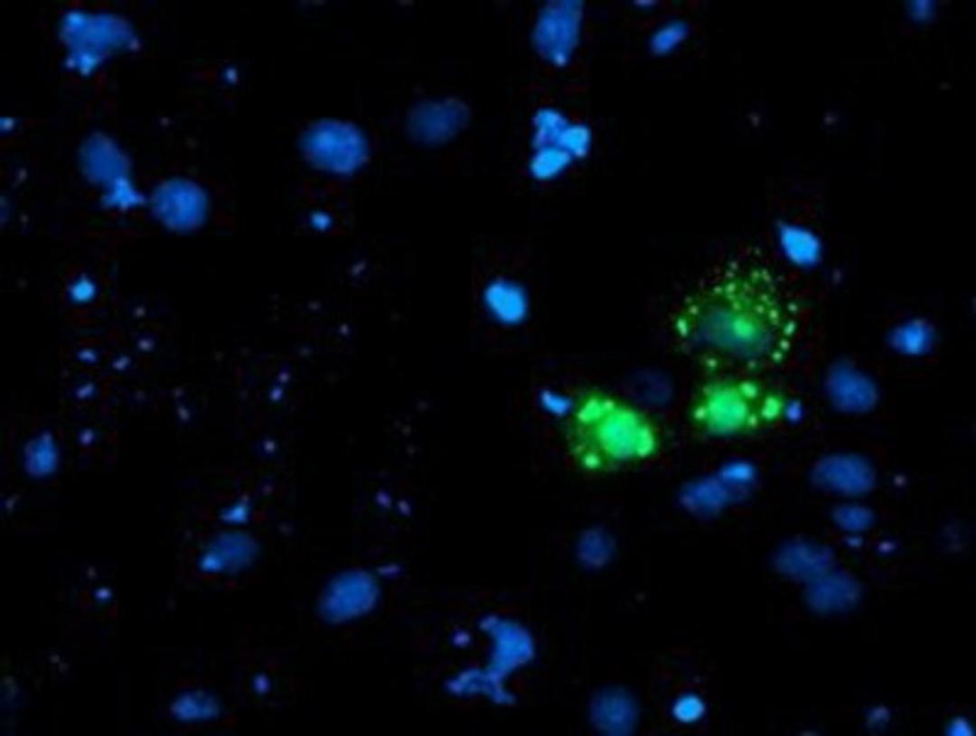 Immunocytochemistry/Immunofluorescence: AP2M1 Antibody (1E9) [NBP2-00834] - Staining of COS7 cells transiently transfected by pCMV6-ENTRY AP2M1.