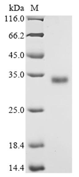 (Tris-Glycine gel) Discontinuous SDS-PAGE (reduced) with 5% enrichment gel and 15% separation gel.